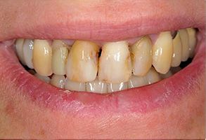 Hagerstown Family Dental | Laser Dentistry, Dental Fillings and Sedation Dentistry