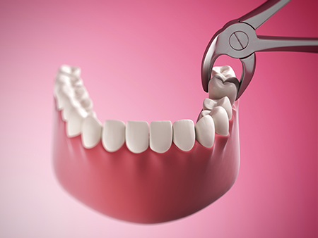 Hagerstown Family Dental